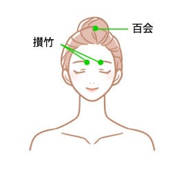 片頭痛に対する重要なツボ