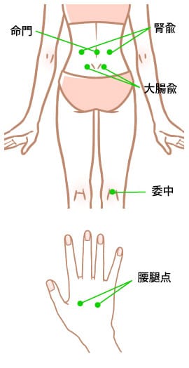 ぎっくり腰に対する重要なツボ